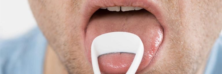 vancouver bad breath